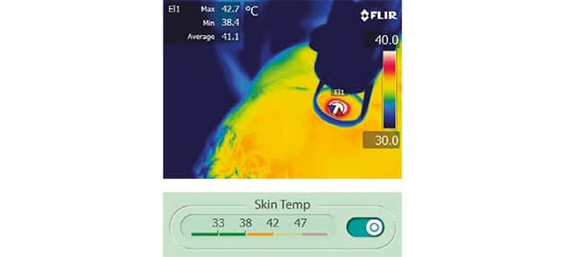 derma-v-temperatura derma-v-temperatura