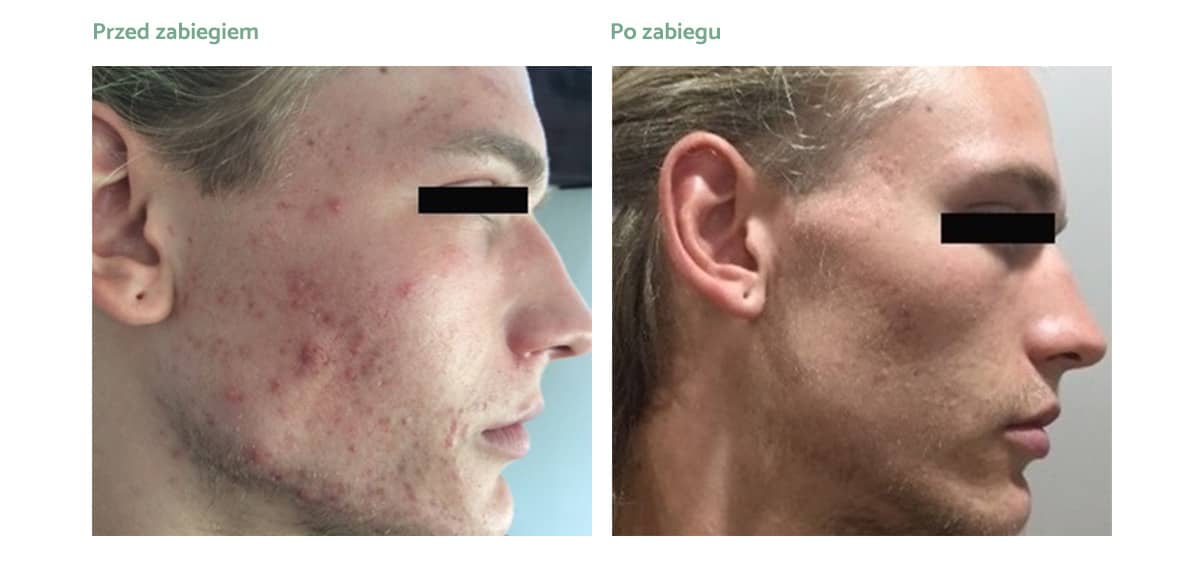 flex-md-rezultaty_zabiegow-01 flex-md-rezultaty_zabiegow-01