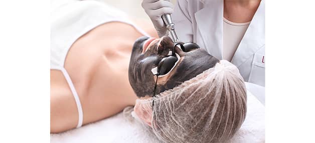 hollywood-spectra-laser-peel hollywood-spectra-laser-peel