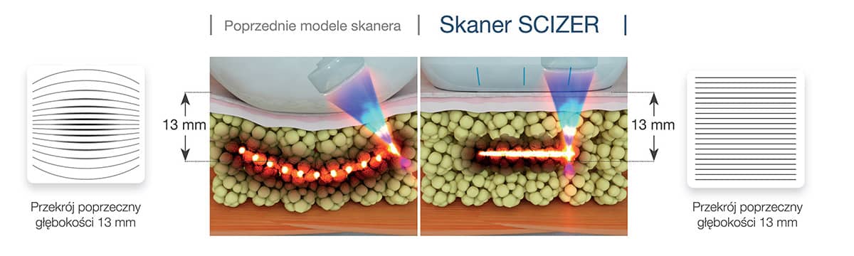 scizer-technologia-jednolitoego-skanowania