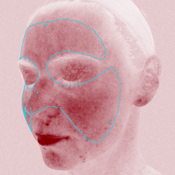 analiza-czerwone-zmiany